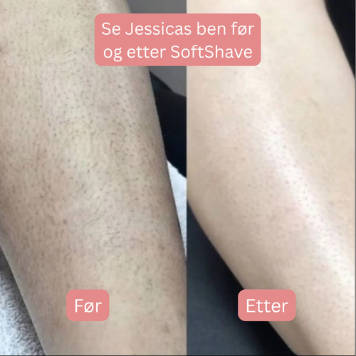 SoftShave™ – For en feilfri, glatt hud uten irritasjon