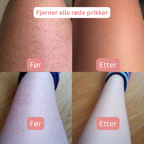 SoftShave™ – For en feilfri, glatt hud uten irritasjon